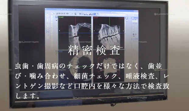 精密検査